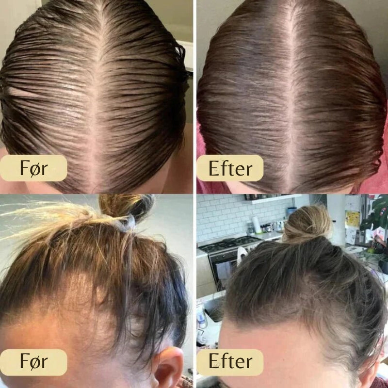 HairNourish – Naturlig hårvækstolie med præcisionsdråber for tykkere
