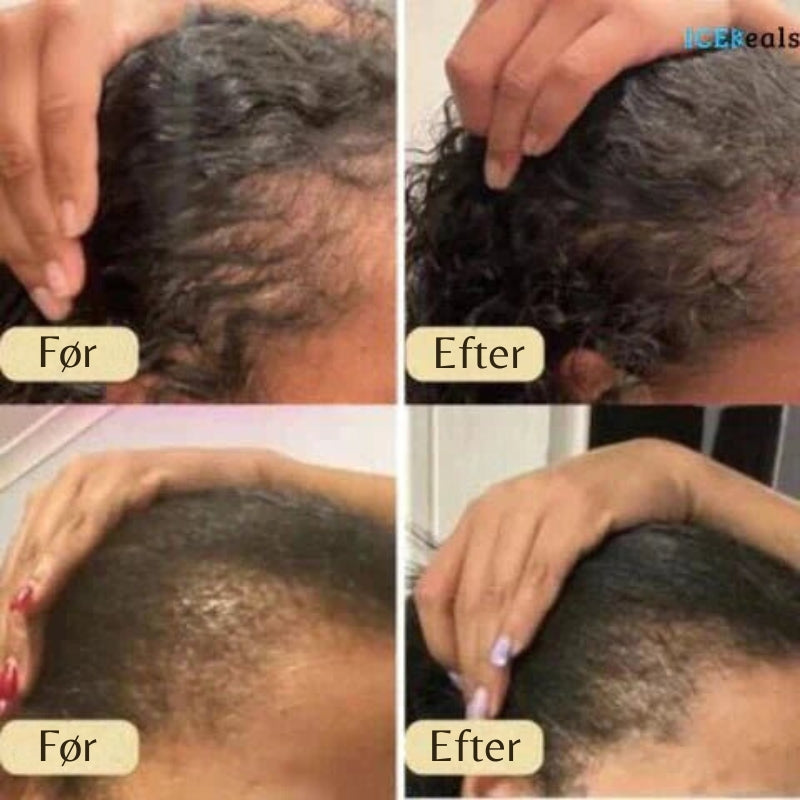 HairNourish – Naturlig hårvækstolie med præcisionsdråber for tykkere