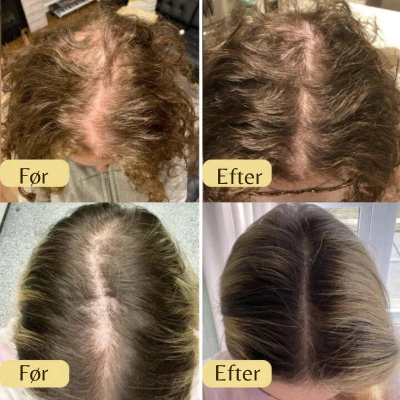 HairNourish – Naturlig hårvækstolie med præcisionsdråber for tykkere